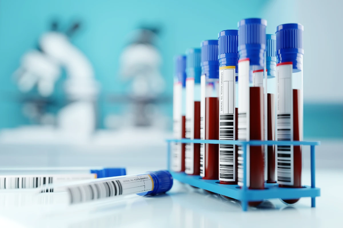 image of blood samples